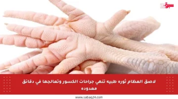 لاصق العظام ثورة طبية تنهي جراحات الكسور وتعالجها في دقائق معدودة